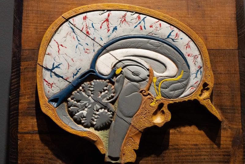 CEREBRO(S) - Imagen 1