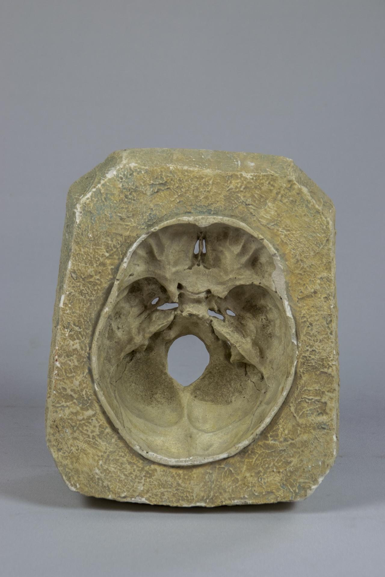 Sección de cráneo