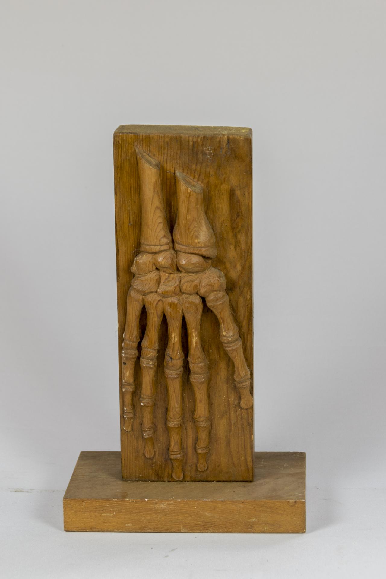 Visión dorsal del esqueleto de la mano