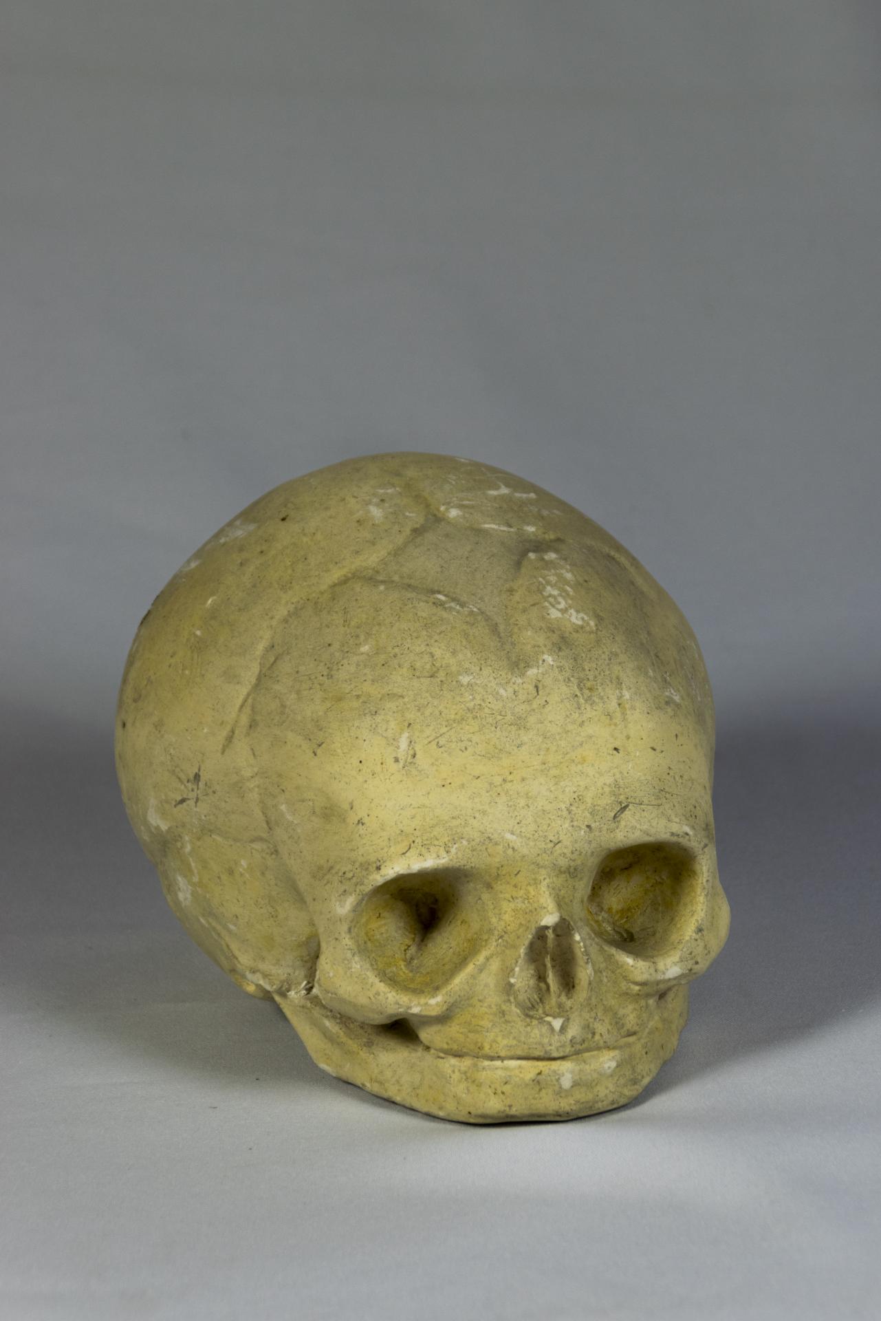 Molde de cráneo fetal