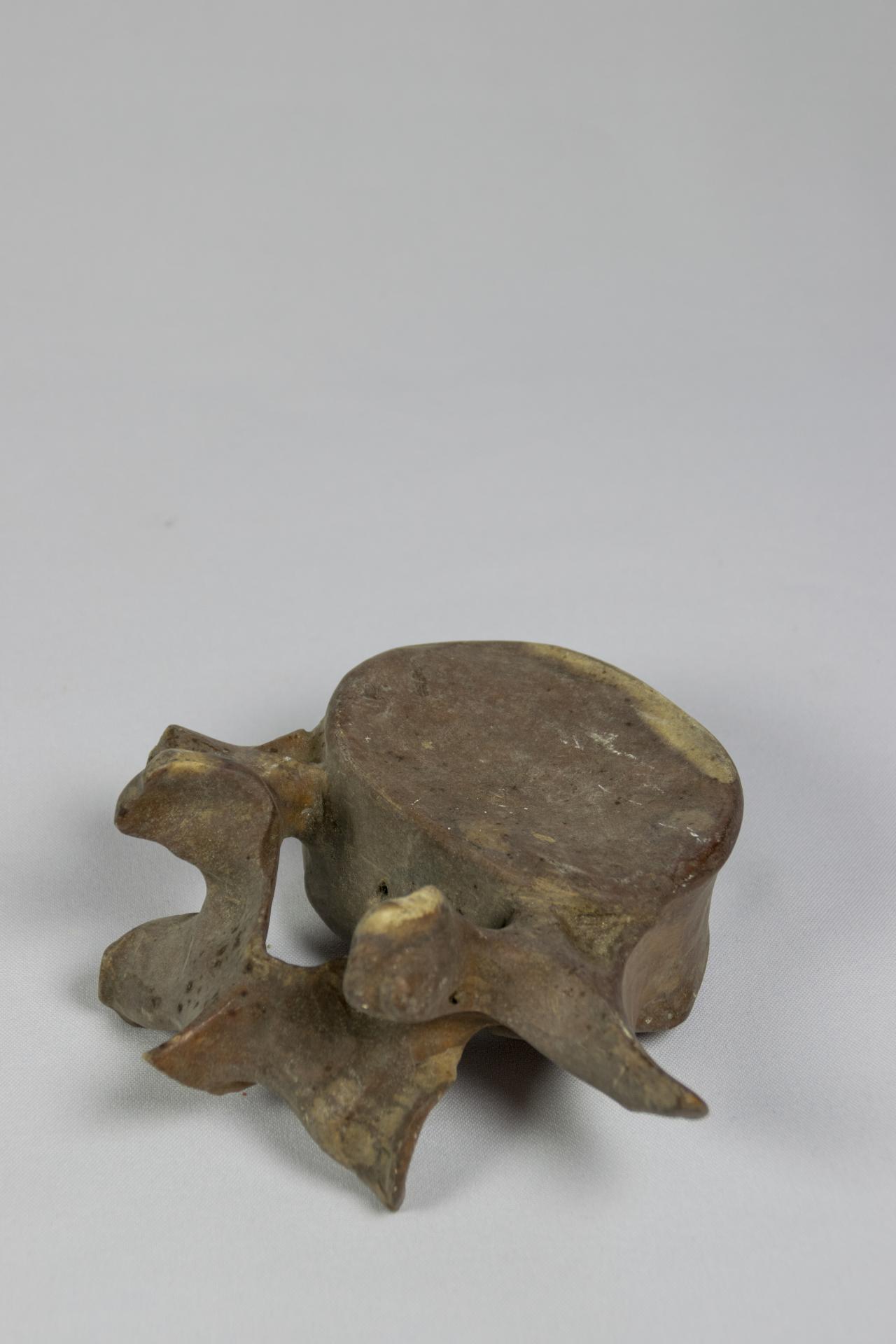 Vértebra lumbar